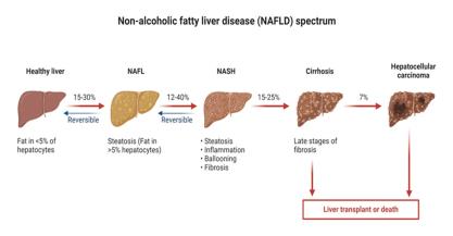 A comprehensive review on Non-Alcoholic Fatty Liver Disease (NAFLD): Clinical Advancement and Drug Treatments