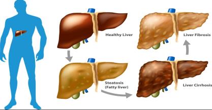 Current Trends in the Treatment of Hepatocellular Carcinoma: Clinical Applications and Advancement